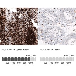 HLA DR/DP Antibody (CL10962), Novus Biologicals 25 &mu;g; Unconjugated:Antibodies,