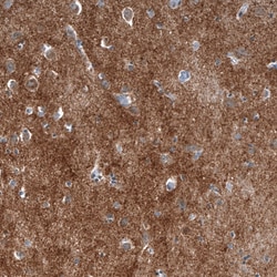 Chromogranin B Antibody (CL11393), Novus Biologicals 25 &mu;g | Buy Online | Novus Biologicals | Fisher Scientific