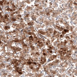 PNMT Antibody (CL11434), Novus Biologicals 100 &mu;g; Unconjugated:Antibodies,