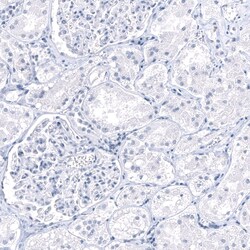 PNMT Antibody (CL11434), Novus Biologicals 100 &mu;g; Unconjugated:Antibodies,