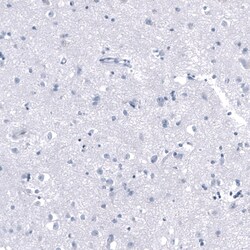 PNMT Antibody (CL11434), Novus Biologicals 100 &mu;g; Unconjugated:Antibodies,