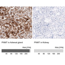 PNMT Antibody (CL11434), Novus Biologicals 100 &mu;g; Unconjugated:Antibodies,