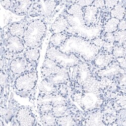 PNMT Antibody (CL11434), Novus Biologicals 100 &mu;g; Unconjugated:Antibodies,