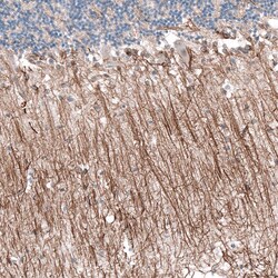 P2X7/P2RX7 Antibody (CL11508), Novus Biologicals:Antibodies:Primary Antibodies