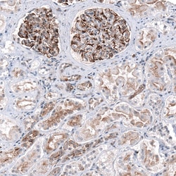 P2X7/P2RX7 Antibody (CL11508), Novus Biologicals:Antibodies:Primary Antibodies