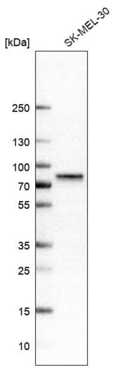 P2X7/P2RX7 Antibody (CL11508), Novus Biologicals:Antibodies:Primary Antibodies