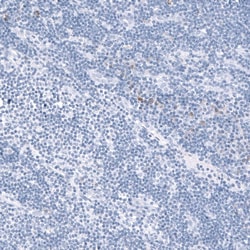 TCF7L2 Antibody (CL11547), Novus Biologicals 25 &mu;g | Buy Online | Novus Biologicals | Fisher Scientific
