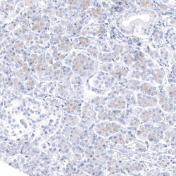 TCF7L2 Antibody (CL11547), Novus Biologicals 25 &mu;g | Buy Online | Novus Biologicals | Fisher Scientific