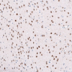TCF7L2 Antibody (CL11547), Novus Biologicals 25 &mu;g | Buy Online | Novus Biologicals | Fisher Scientific