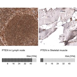 PTEN Antibody (CL11722), Novus Biologicals 25 &mu;g; Unconjugated:Antibodies,