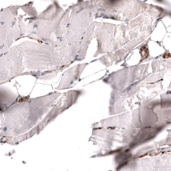 PTEN Antibody (CL11722), Novus Biologicals 25 &mu;g; Unconjugated:Antibodies,