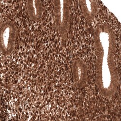 PTEN Antibody (CL11722), Novus Biologicals 25 &mu;g; Unconjugated:Antibodies,