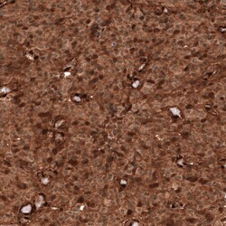 PTEN Antibody (CL11722), Novus Biologicals 25 &mu;g; Unconjugated:Antibodies,