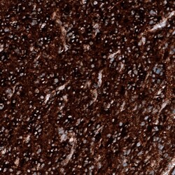 PTEN Antibody (CL11723), Novus Biologicals 25 &mu;g; Unconjugated:Antibodies,