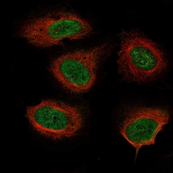 Neurofibromin 1 Antibody (CL11773), Novus Biologicals 100 &mu;g; Unconjugated:Antibodies,