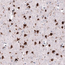 RBFOX3/NeuN Antibody (CL11896), Novus Biologicals:Antikörper:Primärantikörper