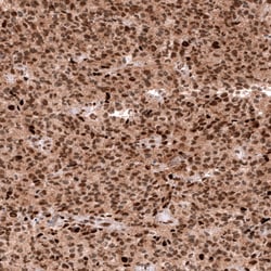 EZH2/KMT6 Antibody (CL11915), Novus Biologicals 100 &mu;g; Unconjugated:Anticorps,