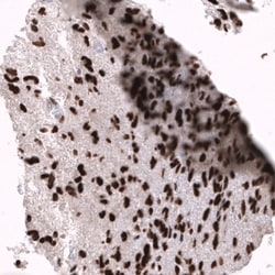 EZH2/KMT6 Antibody (CL11915), Novus Biologicals 100 &mu;g; Unconjugated:Anticorps,