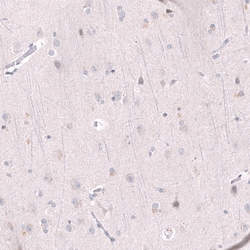 EZH2/KMT6 Antibody (CL11915), Novus Biologicals 100 &mu;g; Unconjugated:Anticorps,