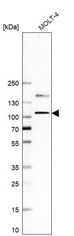 EZH2/KMT6 Antibody (CL11915), Novus Biologicals 100 &mu;g; Unconjugated:Anticorps,