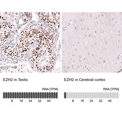 EZH2/KMT6 Antibody (CL11915), Novus Biologicals 100 &mu;g; Unconjugated:Anticorps,