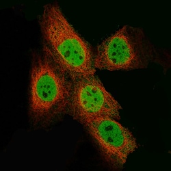 EZH2/KMT6 Antibody (CL11945), Novus Biologicals:Antibodies:Primary Antibodies