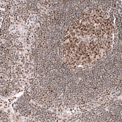 EZH2/KMT6 Antibody (CL11945), Novus Biologicals:Antibodies:Primary Antibodies