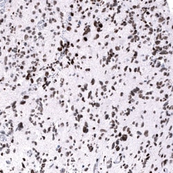 EZH2/KMT6 Antibody (CL11945), Novus Biologicals:Antibodies:Primary Antibodies