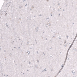 EZH2/KMT6 Antibody (CL11945), Novus Biologicals:Antibodies:Primary Antibodies