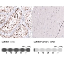 EZH2/KMT6 Antibody (CL11945), Novus Biologicals:Antibodies:Primary Antibodies