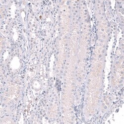 EZH2/KMT6 Antibody (CL11945), Novus Biologicals:Antibodies:Primary Antibodies