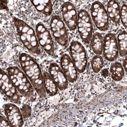 ID1 Antibody (CL11981), Novus Biologicals 100 &mu;g; Unconjugated:Antibodies,