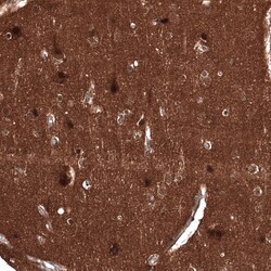 ID1 Antibody (CL11981), Novus Biologicals 100 &mu;g; Unconjugated:Antibodies,
