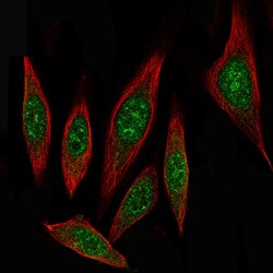 ID1 Antibody (CL11981), Novus Biologicals 100 &mu;g; Unconjugated:Antibodies,