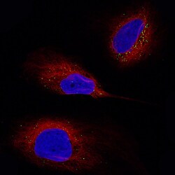 Periostin/OSF-2 Antibody (CL12090), Novus Biologicals 100 &mu;g; Unconjugated:Antibodies,