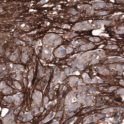 Periostin/OSF-2 Antibody (CL12090), Novus Biologicals 100 &mu;g; Unconjugated:Antibodies,