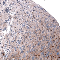 Periostin/OSF-2 Antibody (CL12090), Novus Biologicals 100 &mu;g; Unconjugated:Antibodies,