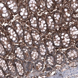 Periostin/OSF-2 Antibody (CL12090), Novus Biologicals 100 &mu;g; Unconjugated:Antibodies,