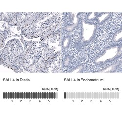 SALL4 Antibody (CL12183), Novus Biologicals 100 &mu;g; Unconjugated:Antibodies,