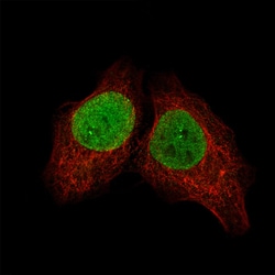 SALL4 Antibody (CL12183), Novus Biologicals 100 &mu;g; Unconjugated:Antibodies,