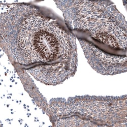 SALL4 Antibody (CL12183), Novus Biologicals 100 &mu;g; Unconjugated:Antibodies,