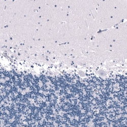 SALL4 Antibody (CL12183), Novus Biologicals 100 &mu;g; Unconjugated:Antibodies,