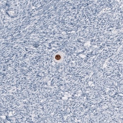SALL4 Antibody (CL12183), Novus Biologicals 100 &mu;g; Unconjugated:Antibodies,