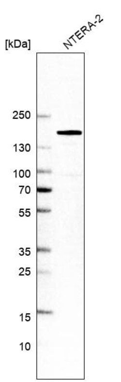 SALL4 Antibody (CL12183), Novus Biologicals 100 &mu;g; Unconjugated:Antibodies,