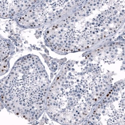 SALL4 Antibody (CL12183), Novus Biologicals 100 &mu;g; Unconjugated:Antibodies,
