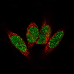 GLI-1 Antibody (CL12191), Novus Biologicals:Antibodies:Primary Antibodies