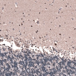 GLI-1 Antibody (CL12192), Novus Biologicals 100 &mu;g; Unconjugated:Antibodies,