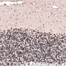 GLI-1 Antibody (CL12192), Novus Biologicals 100 &mu;g; Unconjugated:Antibodies,