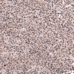 GLI-1 Antibody (CL12192), Novus Biologicals 100 &mu;g; Unconjugated:Antibodies,