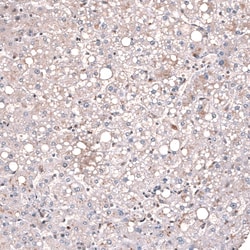 GLI-1 Antibody (CL12192), Novus Biologicals 100 &mu;g; Unconjugated:Antibodies,